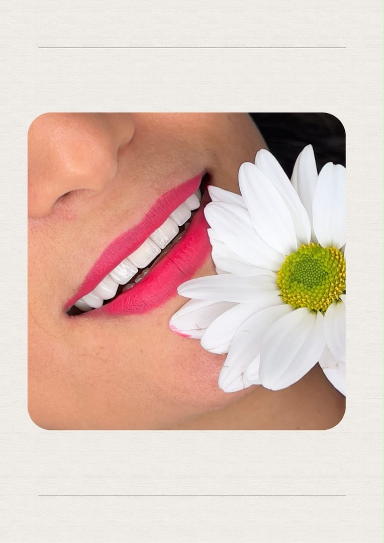 لمینت و طراحی لبخند