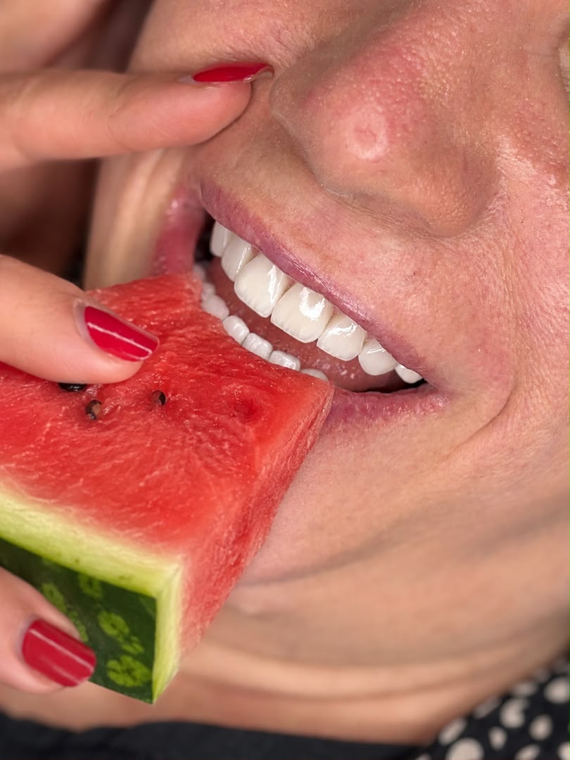 لمینت و طراحی لبخند