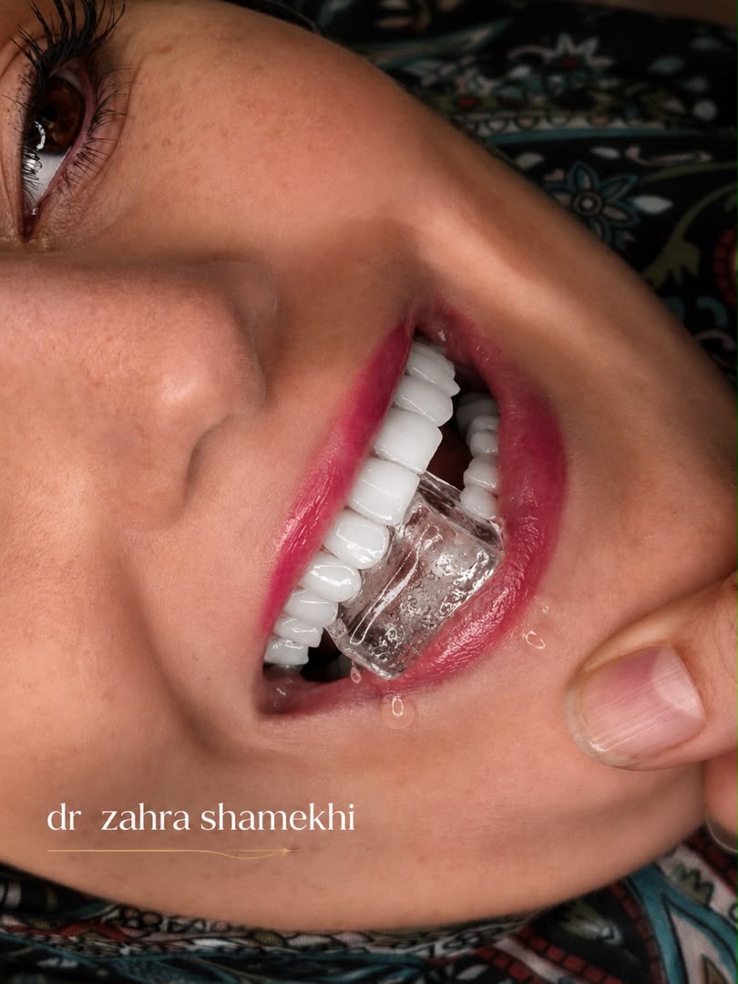 لمینت و طراحی لبخند