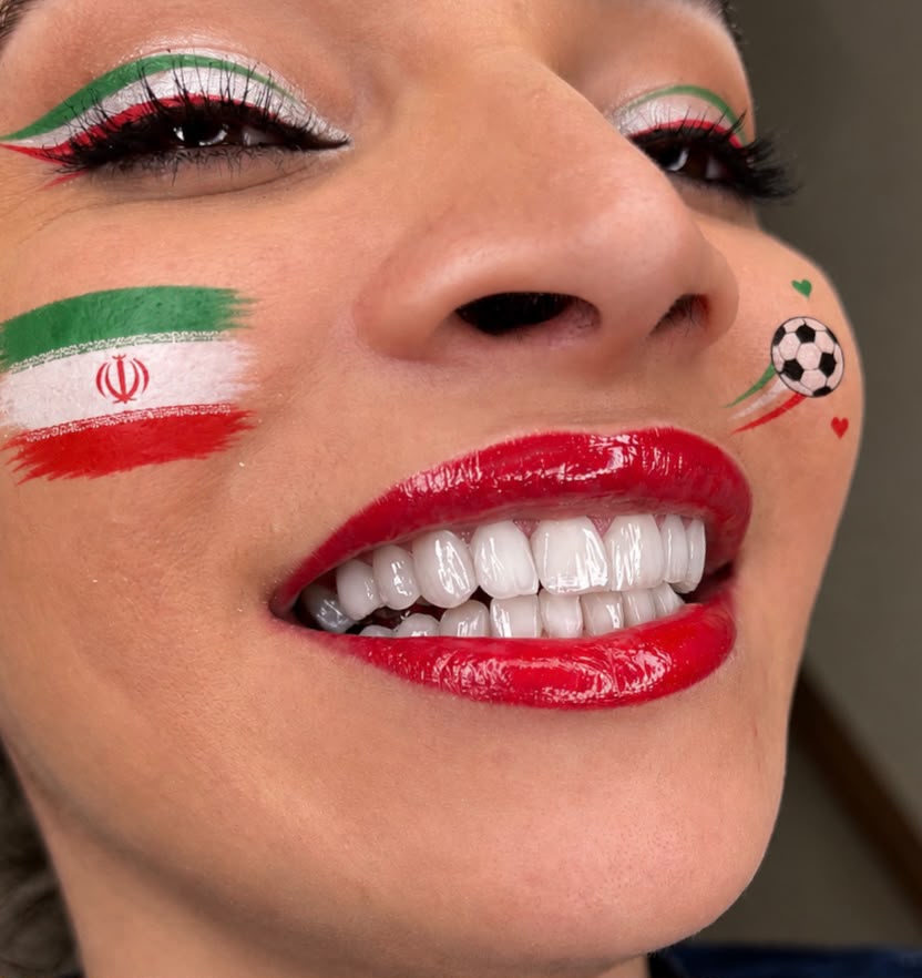 لمینت و طراحی لبخند