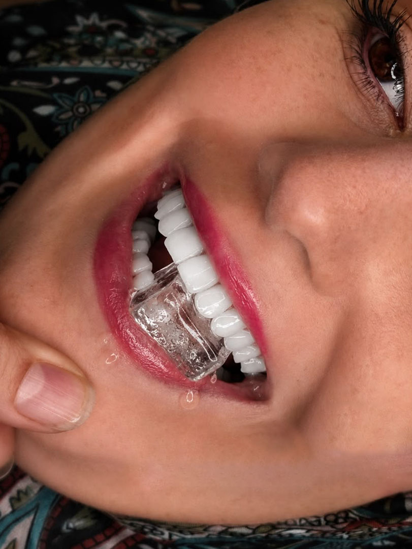 طراحی لبخند و فیسینگ
